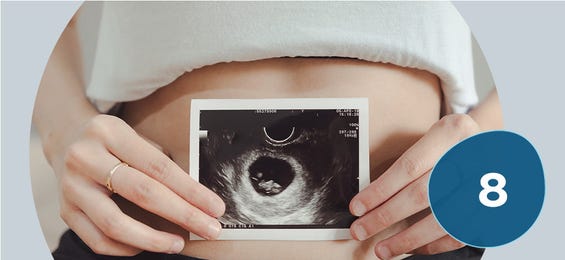 8. Schwangerschaftswoche