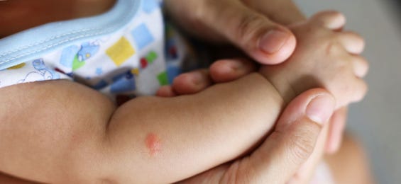 Insektenstiche bei Babys und Kleinkindern